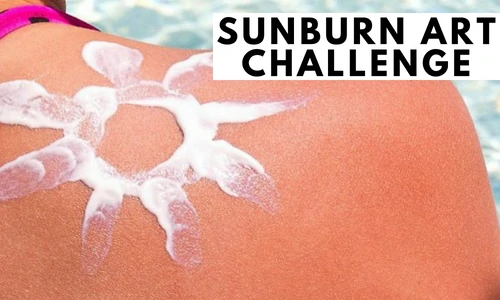 Sunburn Art Challenge